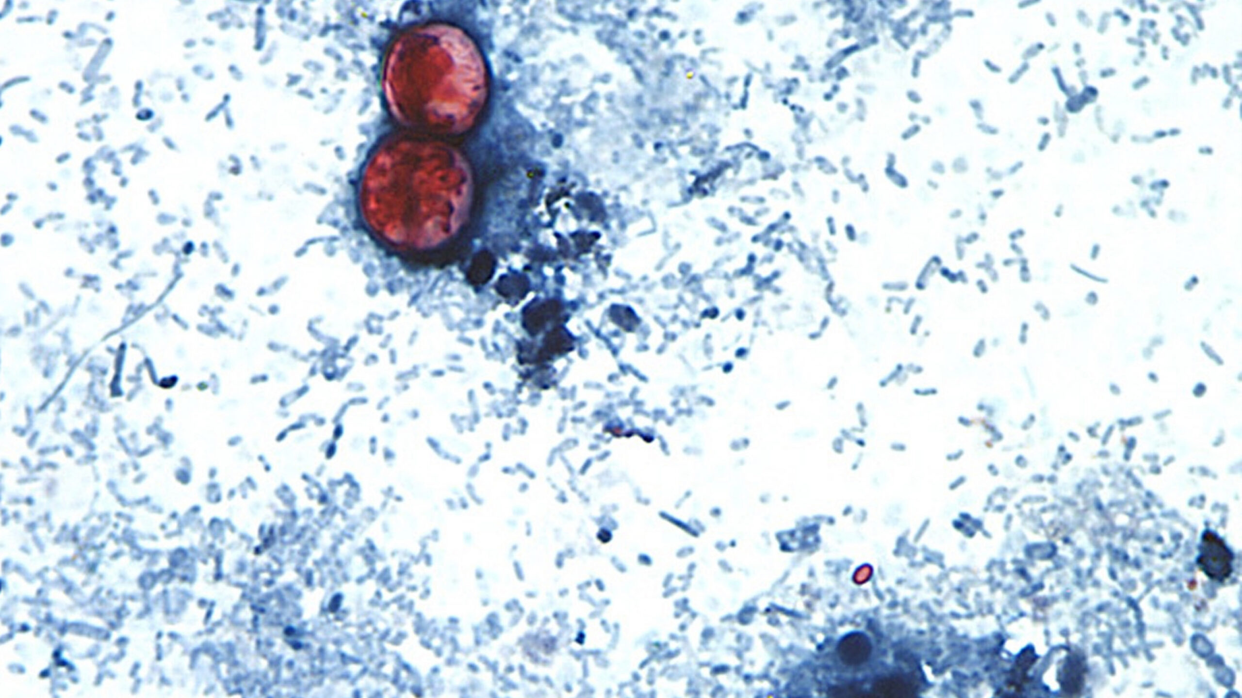 Foodborne Outbreaks